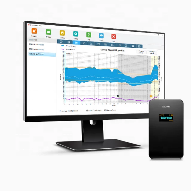 Edan sa-10 monitor para cardiologia
