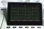 Equipo de Cardiología