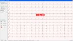 ECG DE03 ESTACIÓN DE TRABAJO FORMA DE ONDA