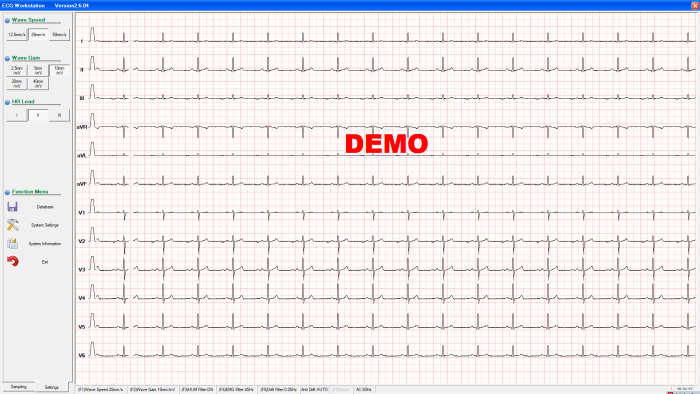 ECG DE03 ESTACIÓN DE TRABAJO FORMA DE ONDA